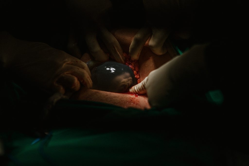 dar a luz y suelo pélvico